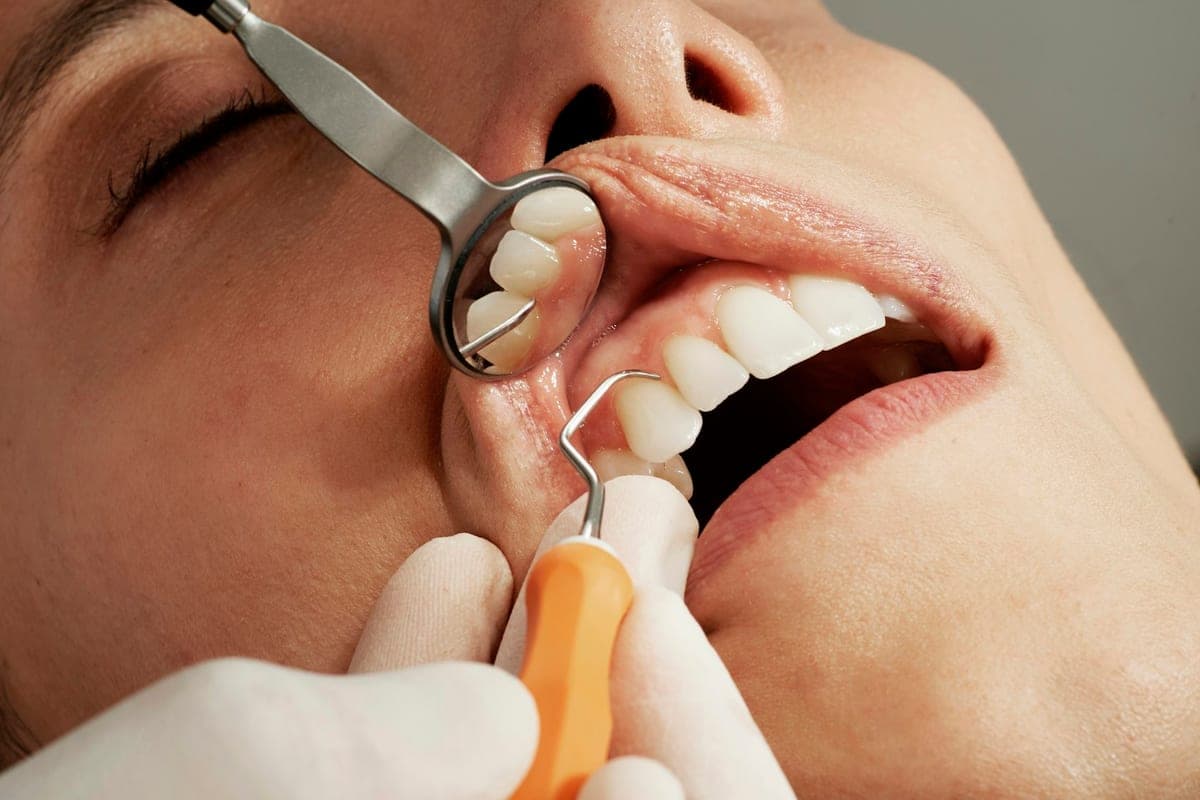 A careful dental examination at Marloe Dental